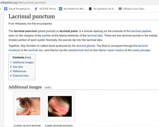 Screenshot from the Wikipedia page titled 'Lacrimal punctum.' The page details the lacrimal punctum, also known as the lacrimal point, which is a small opening on the eyelids. The text explains its function in relation to the lacrimal glands and its connection to the nasal passage. Below the main text, there are two additional images: one showing a close-up of a lacrimal punctum and the other depicting a lower lacrimal punctum